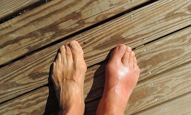 Jaka woda przy dnie moczanowej?